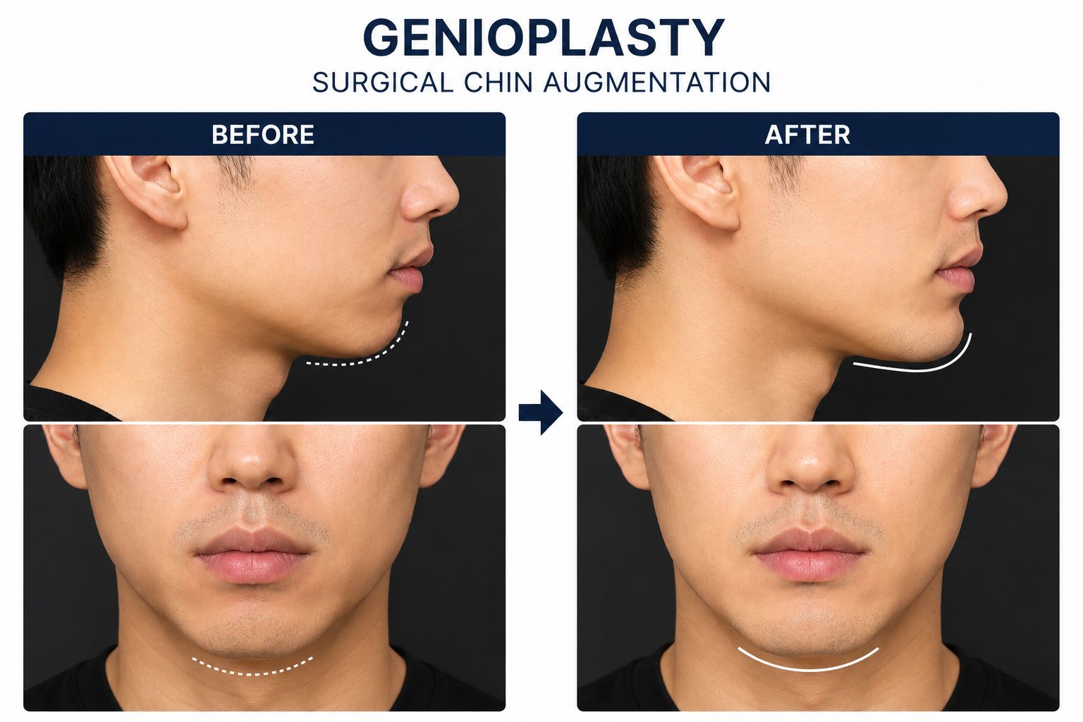 Clinical Results Before and After Showcase